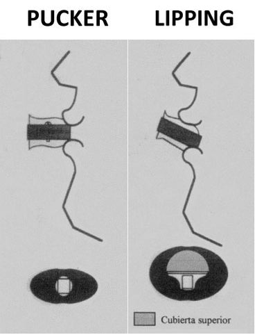 Gráfico comparativo de los 2 métodos de bloqueo de labios